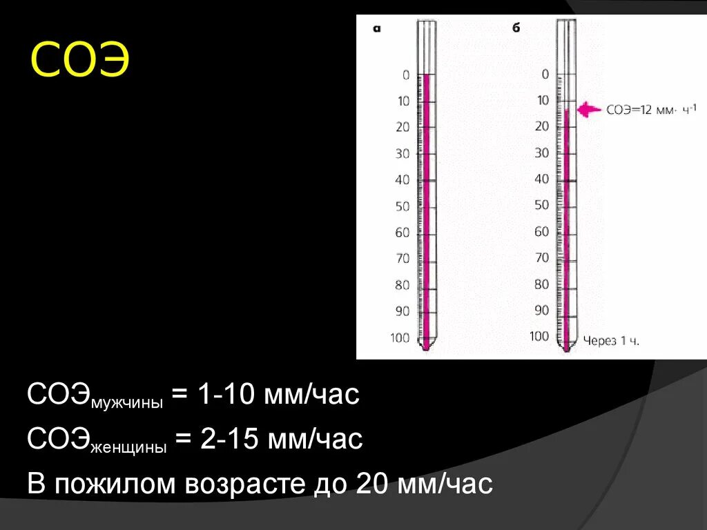 Показатель соэ у мужчин. Скорость реакции оседания эритроцитов норма. Скорость оседания эритроцитов СОЭ норма. СОЭ 22-24. Скорость оседания эритроцитов у мужчин.