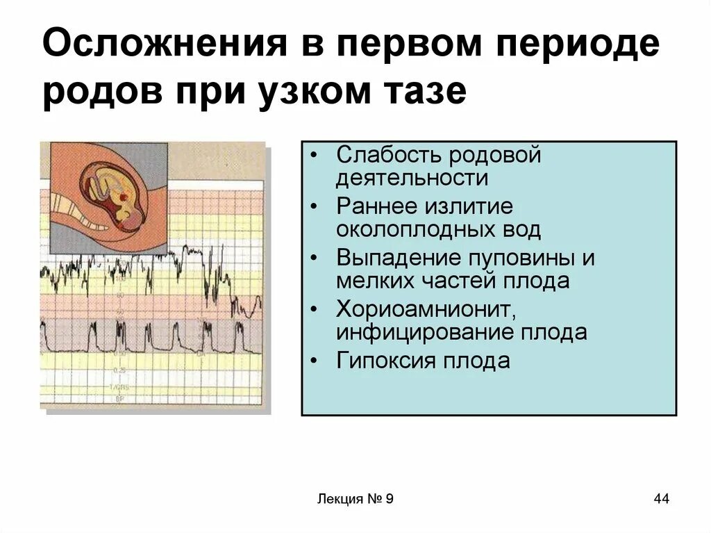 Осложнения первого периода родов. Осложнение при первом периоде родов. Осложнения при 1 периоде родов. Осложнений при узкий таз первый период родов. 4 роды осложнения