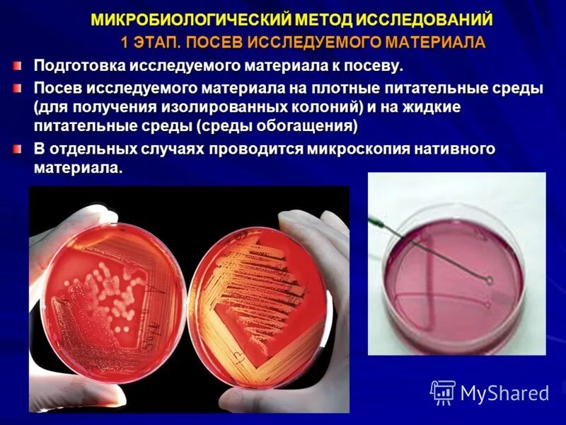 Виды посевов на плотные питательные среды. Посев газоном на чашку петри. Посевы на плотные питательные среды. Посевы на плотные питательные среды. Методы посева микроорганизмов на питательные среды.