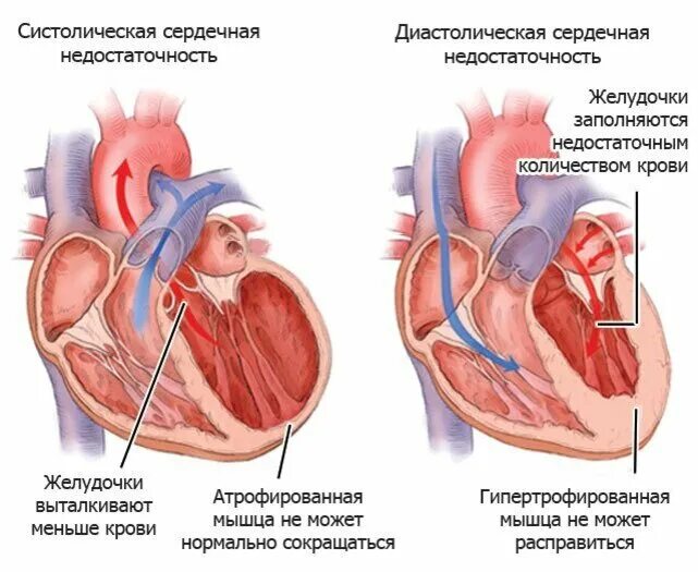 Функция лж сердца