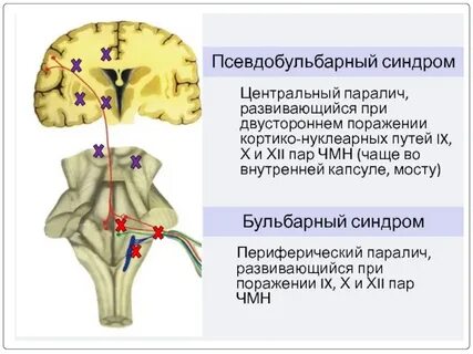 Наличие двусторонней
