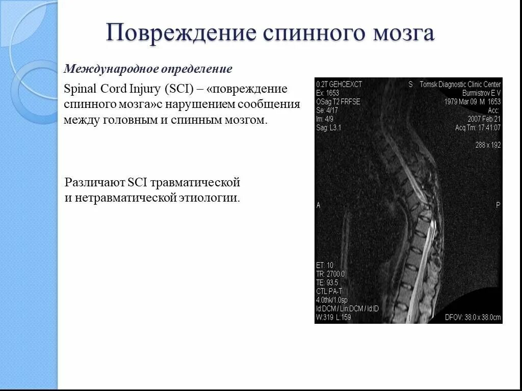 Сотрясение спинного. Травматическое поражение спинного мозга. Повреждение спинного мозга последствия. Неврологические симптомы повреждения спинного мозга. Травма спинного мозга предполагает наличие следующих синдромов.