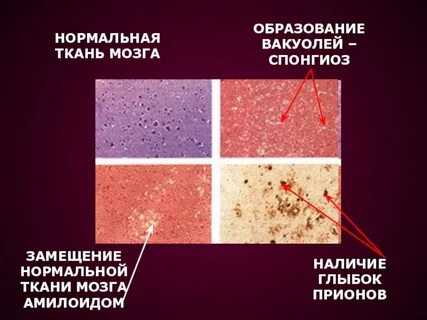 Нормальная ткань