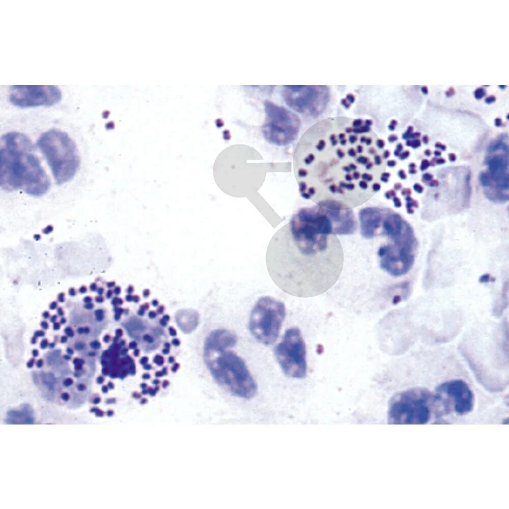 Streptococcus в мазке у мужчин. Гонорея микроскопия мазка. Гонококк микроскопия мазка.