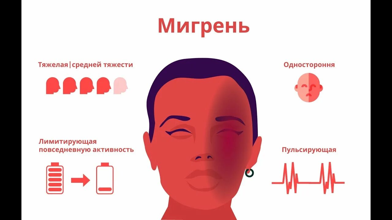 Мигрень у мужчин симптомы и лечение. Мигрень. Мигрень симптомы. Головная боль мигрень. Мигренозная головная боль.