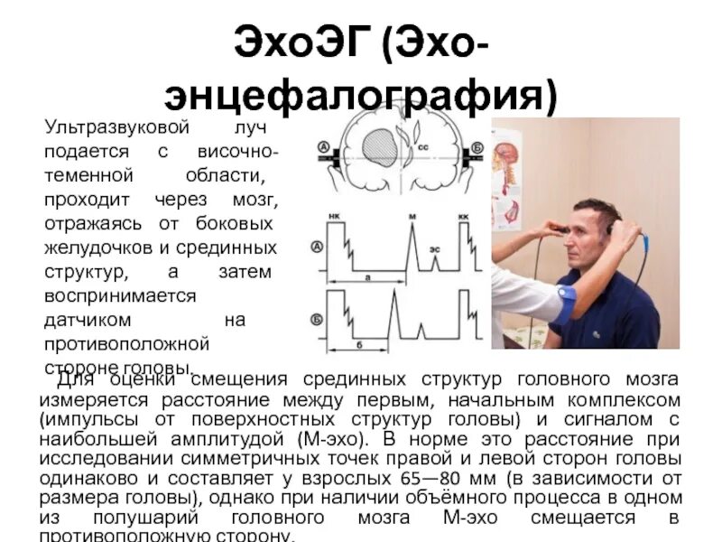 Быстро эхо. Эхоэнцефалография. Показатели Эхо ЭГ. Эхоэнцефалограмма головы. Эхоэнцефалография (ЭХОЭГ).