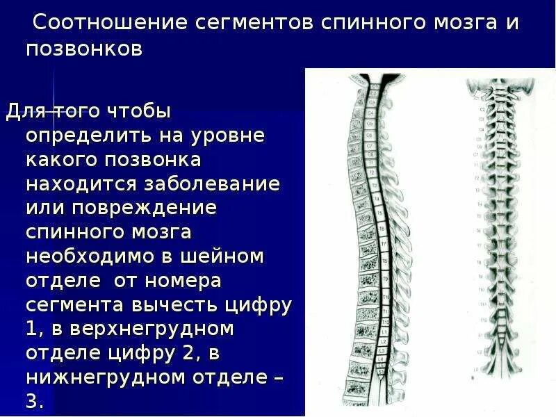 В шейном отделе спинного мозга сегментов. Соответствие сегментов спинного мозга позвонкам. Сегменты спинного мозга на уровне позвонков. Сегменты в шейном отделе спинного мозга. Уровне сегментов спинного мозга на позвонках.