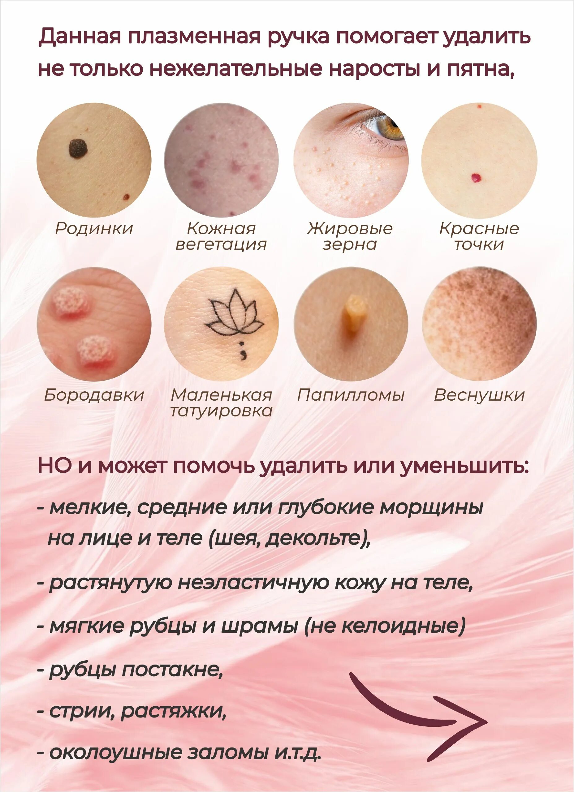 Доброкачественные опухоли влагалища: виды, признаки