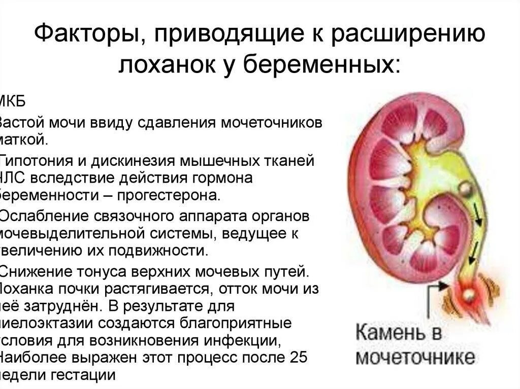 Пиелонефрит статистика. Расширенная почечная лоханка при беременности. Расширение лоханки почки. Расширение лоханки правой почки. Пиелоэктазия почек.