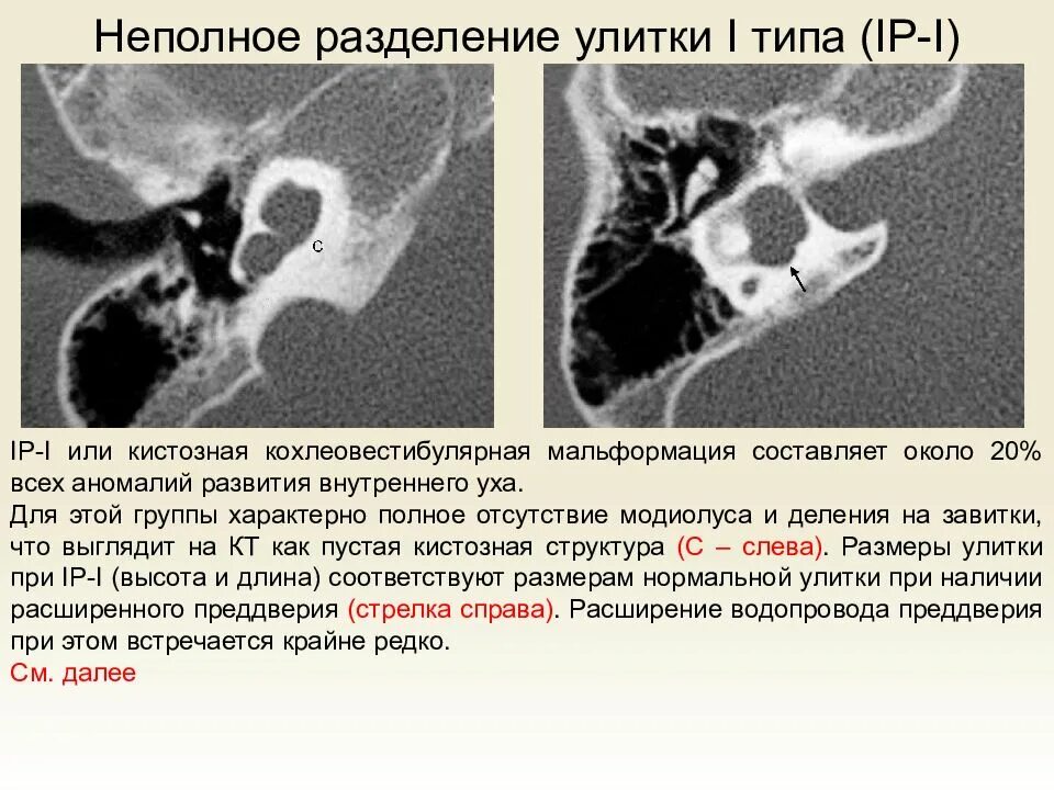 Заболевание кт