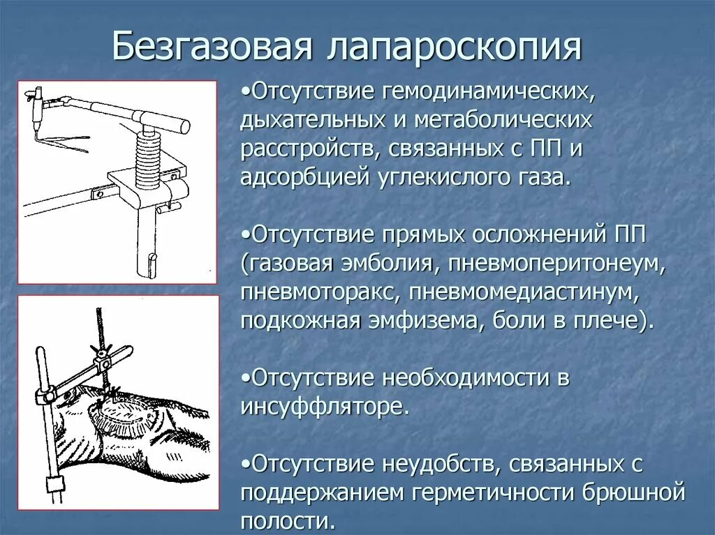 Лапароскопия показания. Безгазовая лапароскопия. Диагностическая лапароскопия этапы операции. В положении операционного стола при лапароскопии.