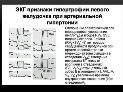 Что означают диффузные изменения миокарда