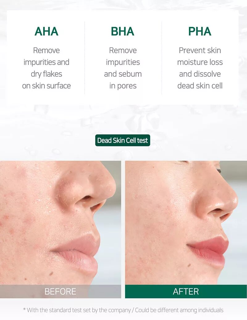 Пилинг aha pha. Aha bha pha 30 days miracle starter. aha bha pha кислоты. комплекс aha и bha. 30days miracle starter.