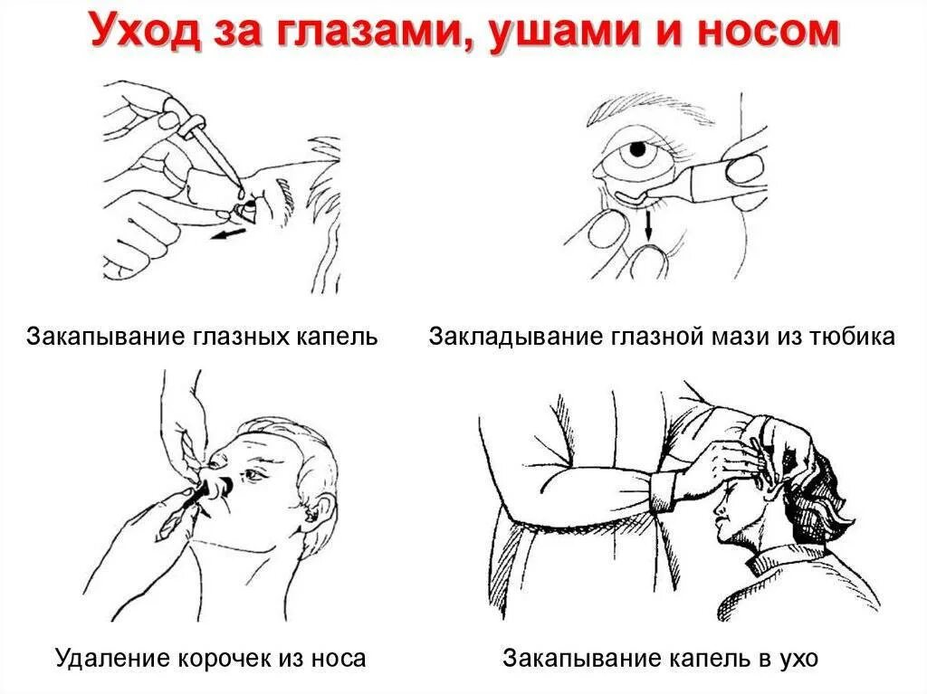 Алгоритм закладывания в глаза. Закапывание капель в глаза алгоритм. закапывание капель в глаза детям алгоритм. капать капли в уши алгоритм. алгоритм закапывания капли в глаза.