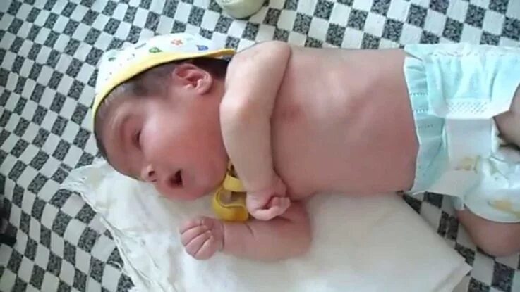 Судороги у ребенка до года как выглядят Судороги у грудничка: как проявляются, симптомы и причины