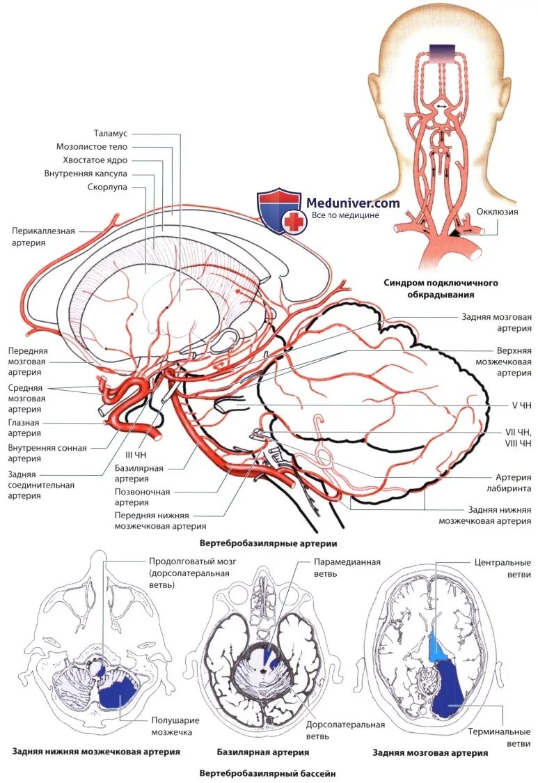 Базилярная артерия головного мозга. Окклюзия базилярной артерии. Синдромы поражения базилярной артерии. Ветви базилярной артерии.