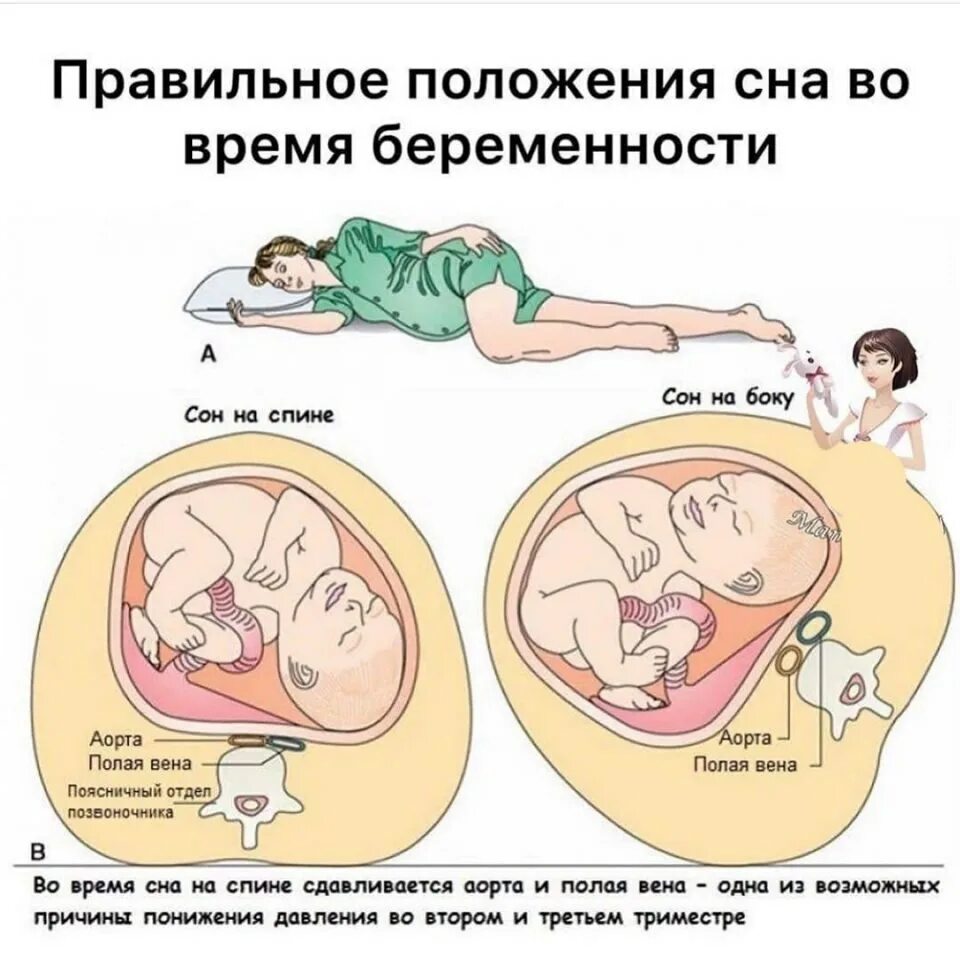 Позы сна для беременных. Как спать беременным. Удобное положение для беременных. Удобное положение для сна при беременности.