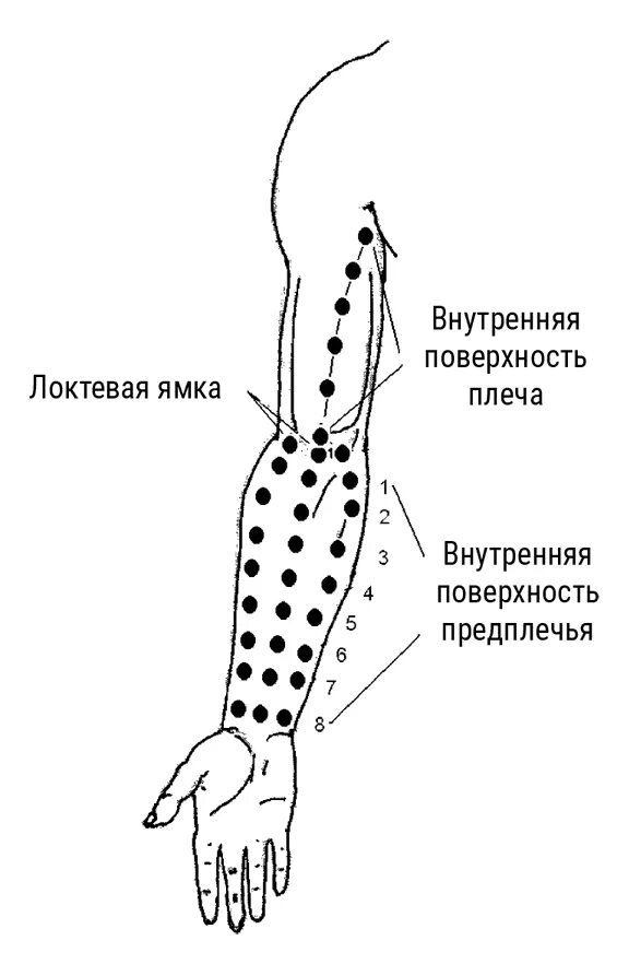 Внутренняя поверхность плеча и предплечья. Средняя треть передней поверхности предплечья. Средняя треть внутренней поверхности предплечья. Средняя треть внутренней поверхности предплечья фото. Внутренняя поверхность плеча