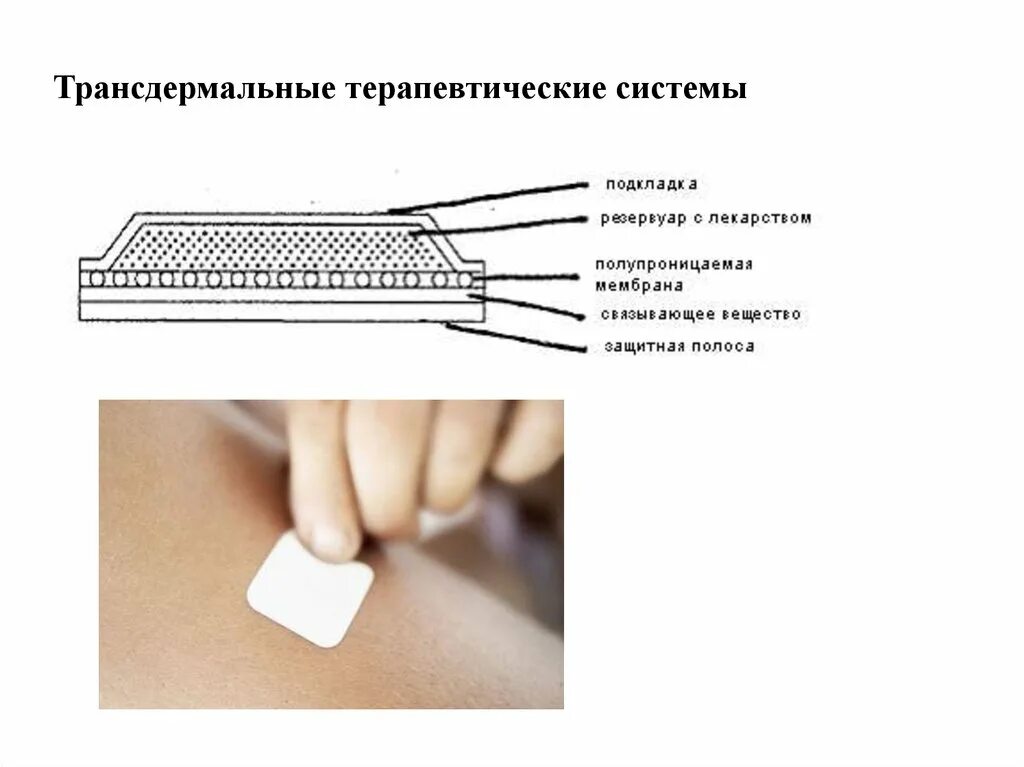 Трансдермальная терапевтическая система ттс это. Трансдермальная терапевтическая система схема. Схема пластырь. Строение трансдермальных терапевтических систем. Перцовый пластырь схема использования.