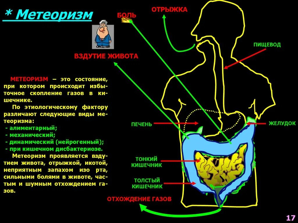 Пучит живот газы у мужчин. Вздутие живота и отрыжка воздухом. Вздутие живота и отрыжки. Метеоризм ГАЗЫ И вздутие живота.