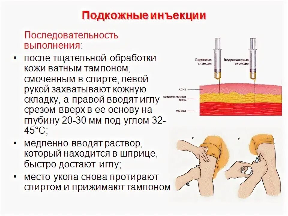 Внутрикожная глубина введения иглы