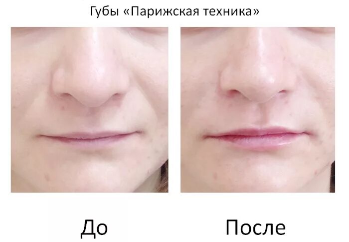 Парижская техника увеличения губ - 79 фото