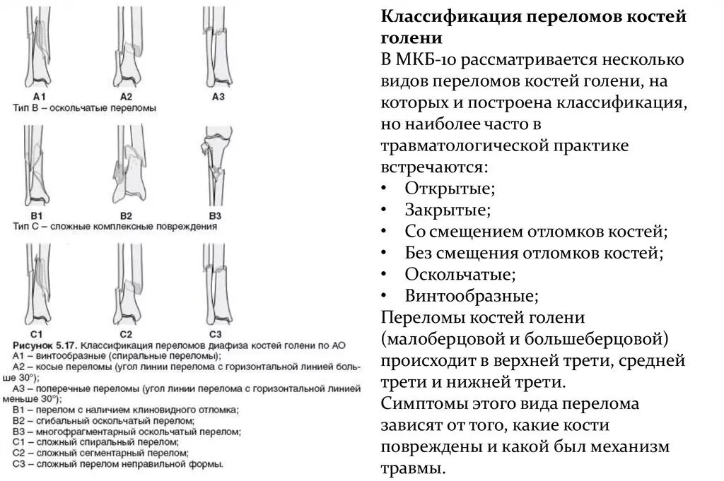 Локальный статус нижних конечностей. Перелом малой берцовой кости классификация. Перелом метаэпифиза малоберцовой кости. Переломы диафиза костей голени классификация. Переломы большеберцовой кости классификация.