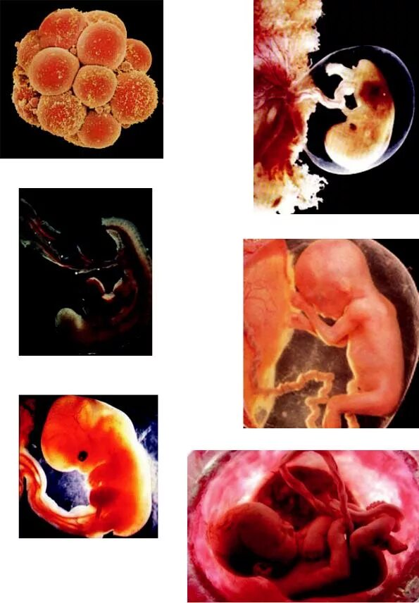1 эмбриональная неделя. Эмбрион на 5 неделе беременности. Развивание беременности зародыш. Эмбриональный период беременности. Формирование плода человека.