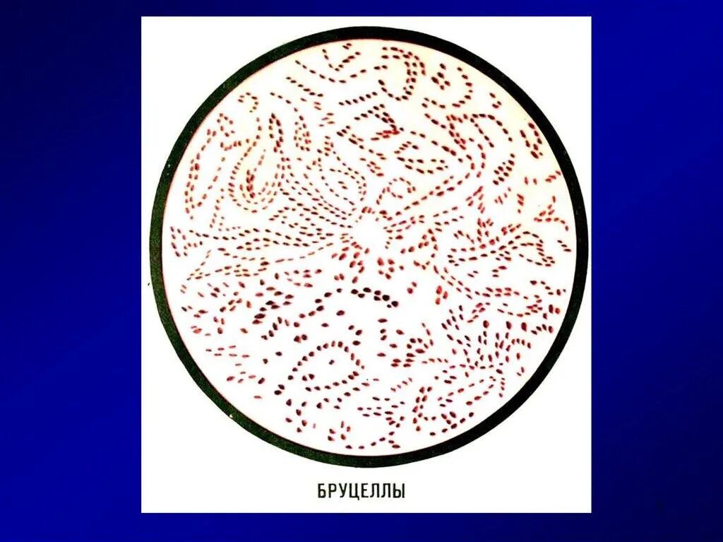 Brucella spp. Бруцеллы микроскопия. бруцелла абортус. brucella melitensis микробиология. brucella abortus микробиология.