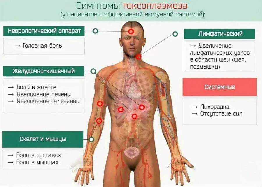 Токсоплазмоз симптомы у чел. Токсоплазмоз клинические проявления. Клинический симптом токсоплазмоза:. Симптомы и лечение осложнений