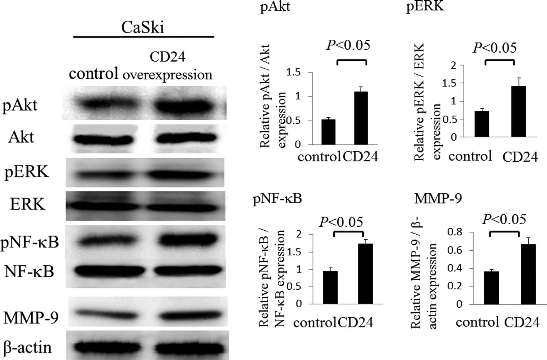 ВИЧ вестерн блоттинг. Иммунный Блот. Иммунный блоттинг на ВИЧ. Mmp9 Western blot. Иммунный блоттинг