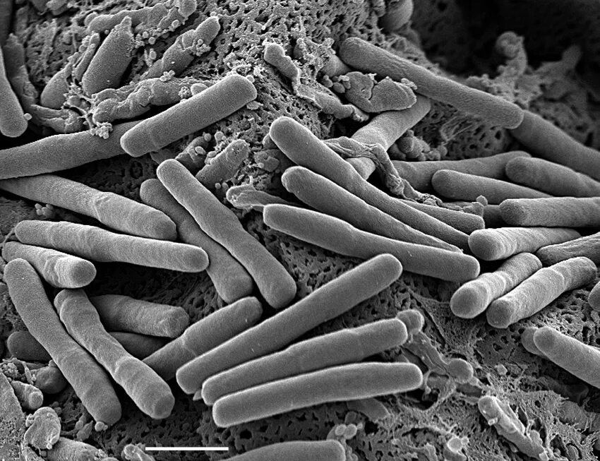 Клостридиум диффициле. Клостридии в микроскопе. Clostridium difficile микробиология.