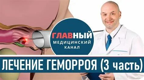 Эффективное лечение внутреннего геморроя у мужчин