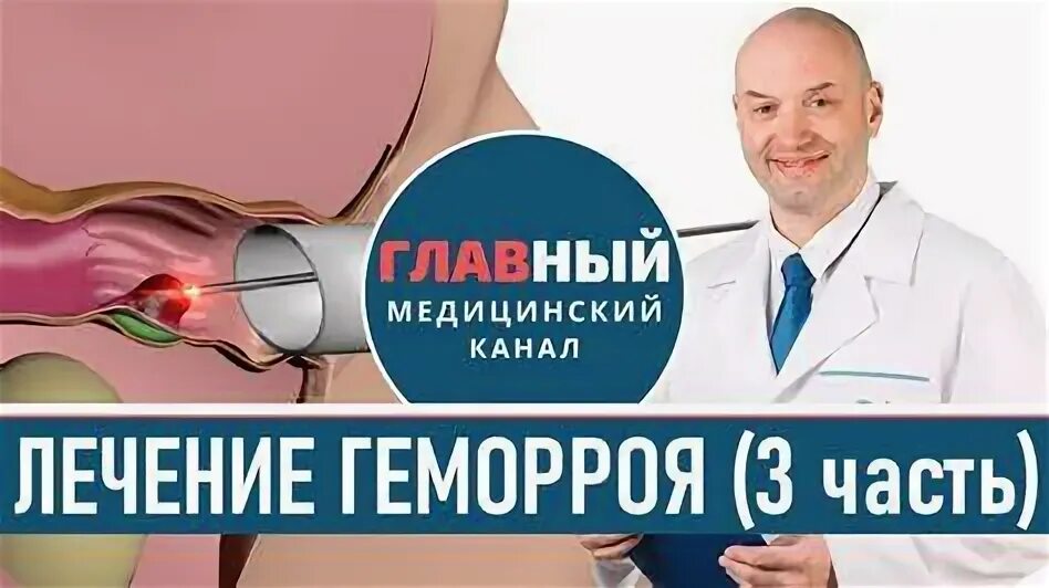 Причины появления геморроя. Как выглядит геморроидальный узел. Консервативное лечение геморроя препараты. Профилактика при геморрое. Воспаление наружных геморроидальных узлов.