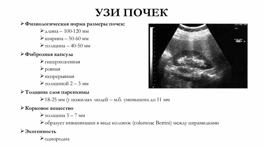 Узи брюшной полости полный мочевой пузырь. Ультразвуковое исследование почек объем в норме. Параметры почек на УЗИ норма. Размер левой почки в норме по УЗИ. Показатели нормы при УЗИ почек.