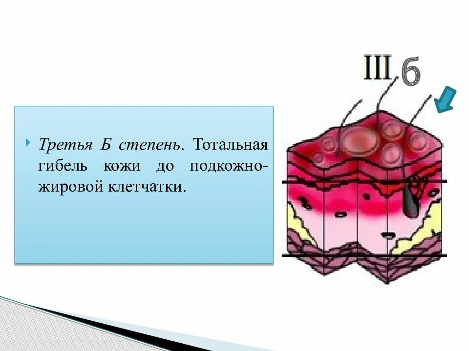 раскрытие скобок формулы сокращенного умножения. б 3 степень. б3 и б4 категория годности. хроническая болезнь почки стадия 3 что это. б 3 степень.