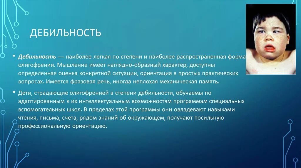 Умственная отсталость ИМБ. Умственная отсталость дебильность Имбецильность идиотия. Степени умственной отсталости олигофрения. Дебильность это степень умственной отсталости.