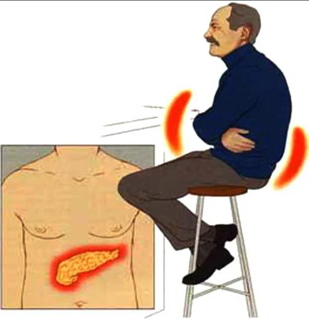 Панкреатит локализация. Боль при хроническом панкреатите. Панкреатит локализация боли.
