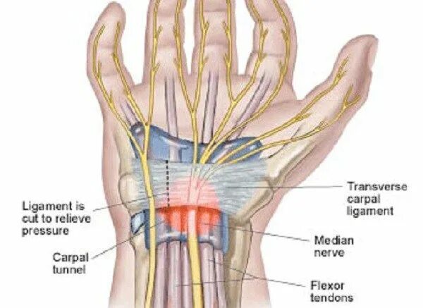 Канал запястья. Мышцы запястного канала. Запястный канал границы. После операции запястного канала