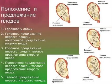 Положение эмбриона