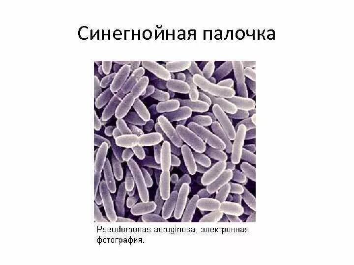 Синегнойная палочка микроскопия. Синегнойная палочка цитология. Pseudomonas aeruginosa (синегнойная палочка). Бактериоскопия синегнойная палочка.