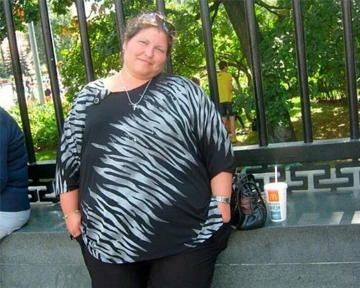 Как выглядит 150 человек Arizona man who lost over 300 pounds fundraises for skin surgery Fox News