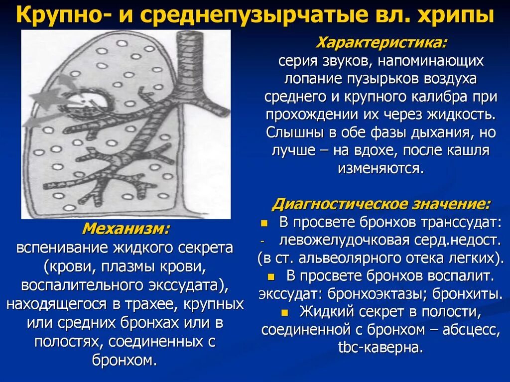 Среднепузырчатые хрипы в легких. Крупнопузырчатые хрипы в легких заболевание. Влажные среднепузырчатые хрипы. Средне и крупнопузырчатые хрипы.