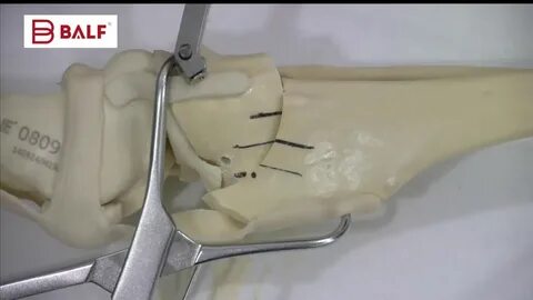 Операция tplo собаке