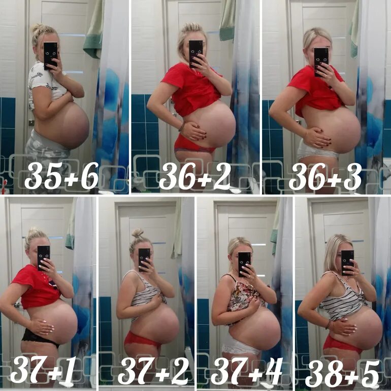 Опустившийся живот у беременных. Опущенный живот у беременных. 37 недель опустился