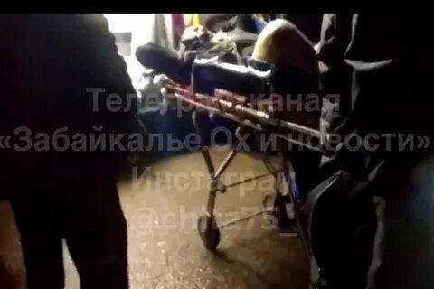 Стрельба в фицо