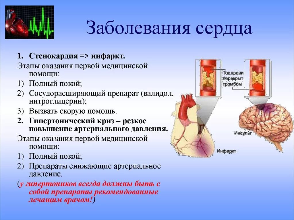 Сердечные болезни. Болезни сердца список названий. Заболевания связанные с сердцем.