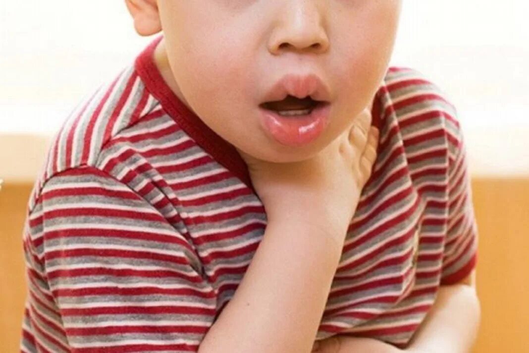 ребенок задыхается аллергия. весенний поллиноз. ребенок задыхается. анафилактический шок у детей. ребенок задыхается аллергия.