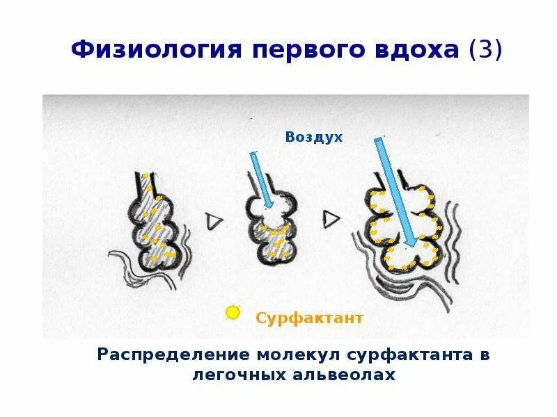 Механизм первого вдоха новорожденных. Механизм первого вдоха новорожденного ребенка физиология. Механизм вдоха новорожденного схема. Механизм первого вдоха у новорожденных физиология. С первым вдохом