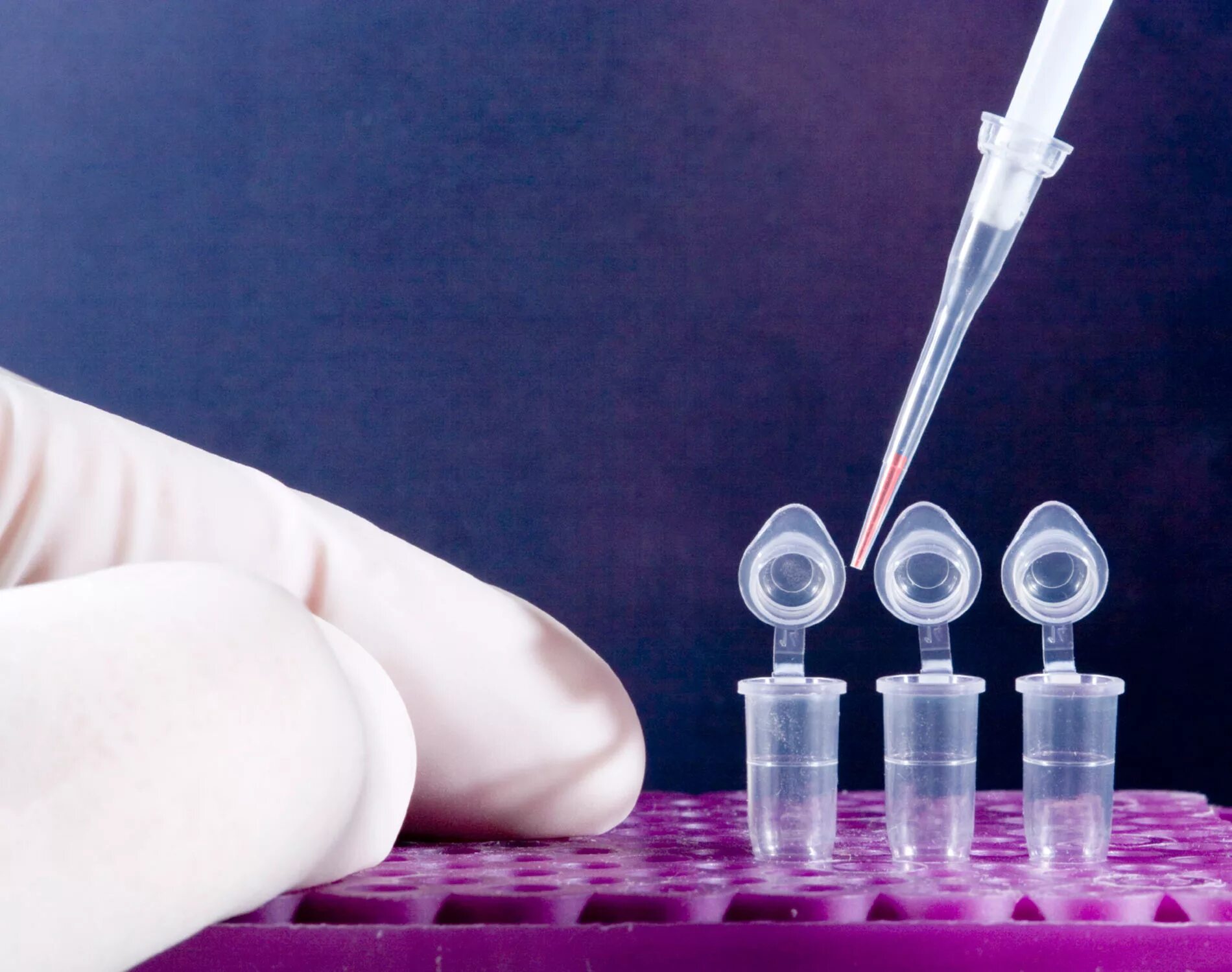 Pcr — полимеразная цепная реакция. Пцр отменят. Полимеразная цепная реакция (пцр). Пцр серологический метод. Пцр исследование мокроты на туберкулез.